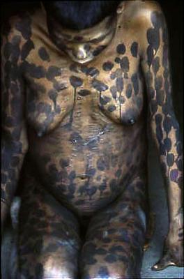 Série Xingu - Pintura corporal característica do povo Panará