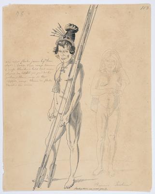 Bororos. Fazenda Jacobina. Sexdigitário no pé esquerdo.