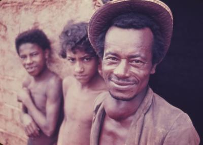 Morador do Vale do Jequitinhonha com bócio