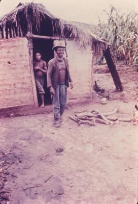 Morador de Diamantina com bócio